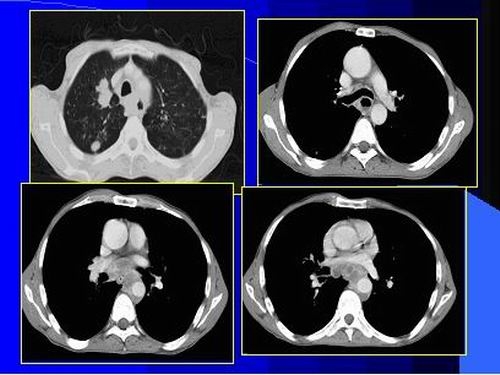 Tomografia computerizata (ct) in contextul celorlalte mijloace imagistice de diagnostic